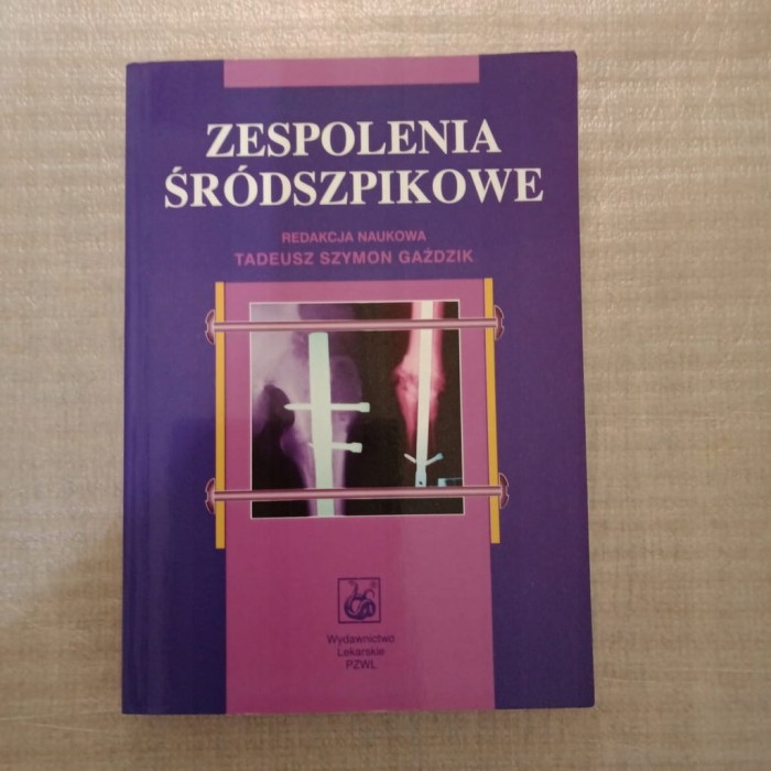 Zespolenia śródszpikowe Tadeusz Szymon Gaździk