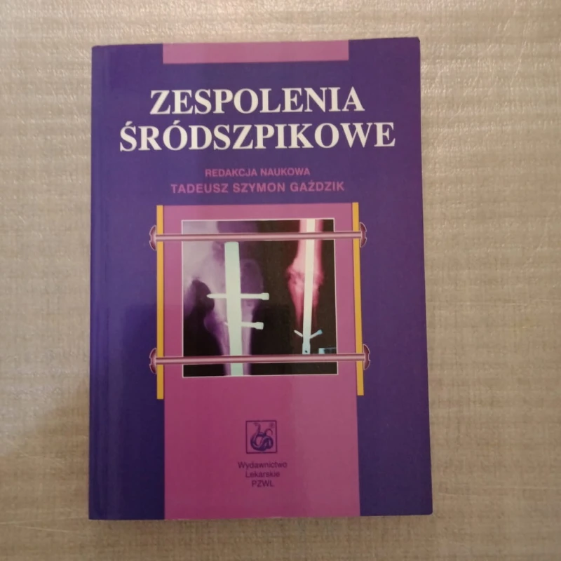 Zespolenia śródszpikowe Tadeusz Szymon Gaździk
