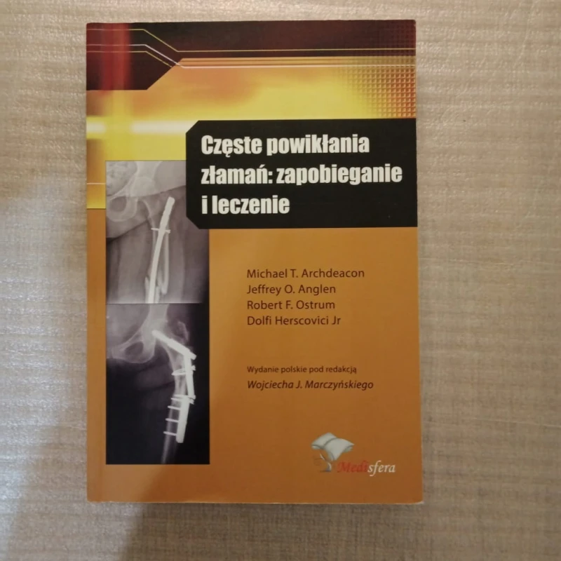 CZĘSTE POWIKŁANIA ZŁAMAŃ: ZAPOBIEGANIE I LECZENIE Michael T. Archdeacon