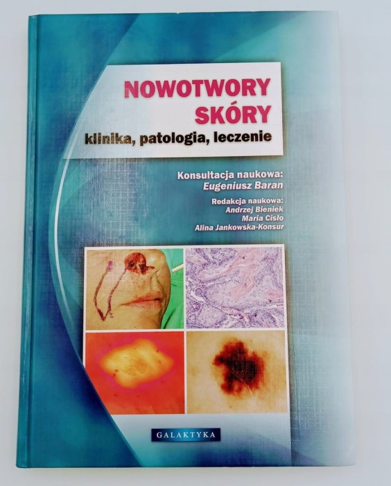 NOWOTWORY SKÓRY KLINIKA PATOLOGIA LECZENIE Eugeniusz Baran