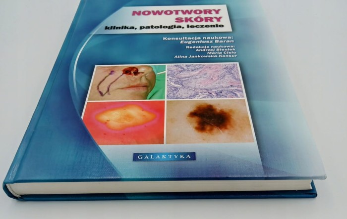 NOWOTWORY SKÓRY KLINIKA PATOLOGIA LECZENIE Eugeniusz Baran