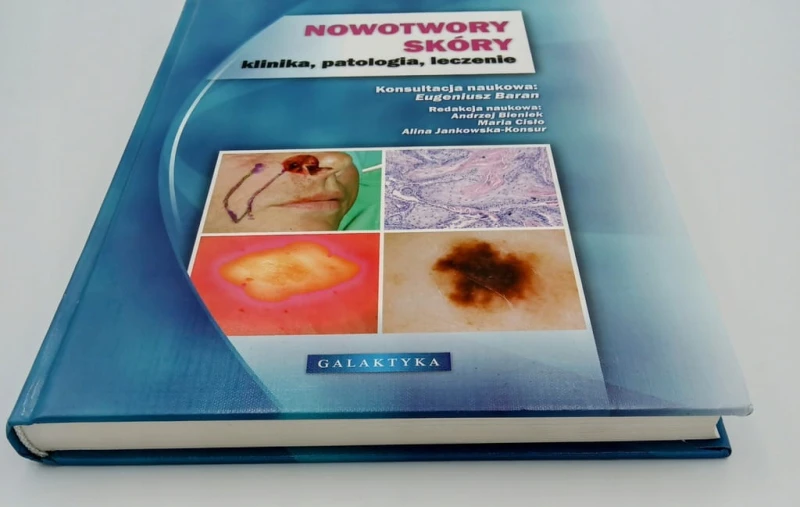 NOWOTWORY SKÓRY KLINIKA PATOLOGIA LECZENIE Eugeniusz Baran