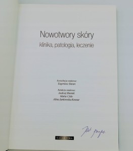 NOWOTWORY SKÓRY KLINIKA PATOLOGIA LECZENIE Eugeniusz Baran
