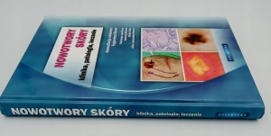 NOWOTWORY SKÓRY KLINIKA PATOLOGIA LECZENIE Eugeniusz Baran