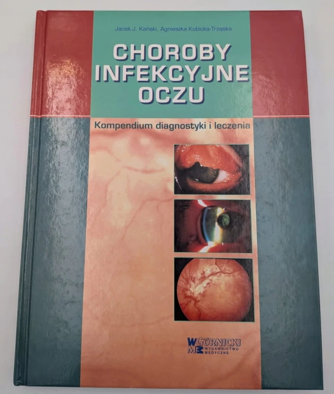 Choroby infekcyjne oczu. Kompendium diagnostyki i leczenia Jacek J. Kański