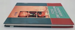 Choroby infekcyjne oczu. Kompendium diagnostyki i leczenia Jacek J. Kański
