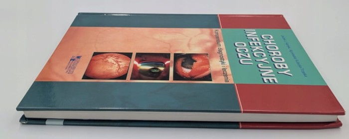 Choroby infekcyjne oczu. Kompendium diagnostyki i leczenia Jacek J. Kański