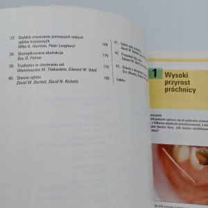 Rozwiązywanie problemów klinicznych w stomatologii Edward W Odell