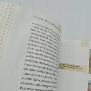 Dermatologia wybrane przypadki kliniczne Praca zbiorowa