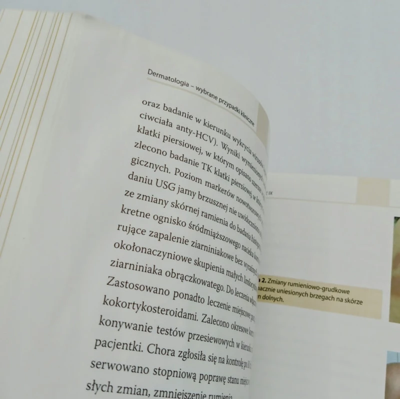 Dermatologia wybrane przypadki kliniczne Praca zbiorowa